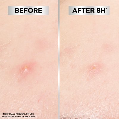 before and after