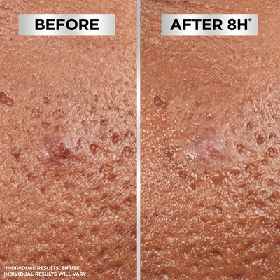 before and after